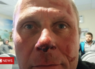 Man who ‘picked officer up by his nostrils’ gets 7 years (Details)