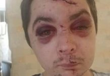 Edmonton: Vicious 4-on-1 attack lands Spruce Grove man in hospital