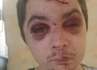 Edmonton: Vicious 4-on-1 attack lands Spruce Grove man in hospital