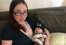 Report: ‘It’s really hard right now’: Calgary couple struggles with infant son’s rare skin disease