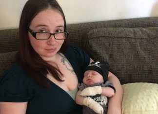 Report: ‘It’s really hard right now’: Calgary couple struggles with infant son’s rare skin disease