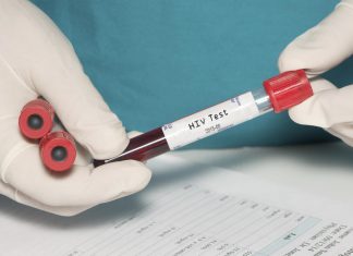 Man awarded $18.4 million in lawsuit over failed HIV test (Details)
