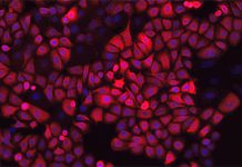 Finding the best method to grow bioengineered tissue for pulmonary study Finding the best method to grow bioengineered tissue for pulmonary study