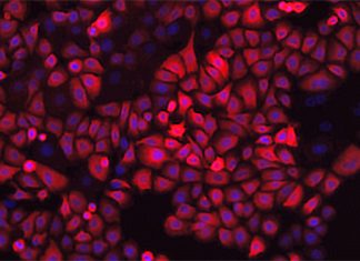 Finding the best method to grow bioengineered tissue for pulmonary study Finding the best method to grow bioengineered tissue for pulmonary study