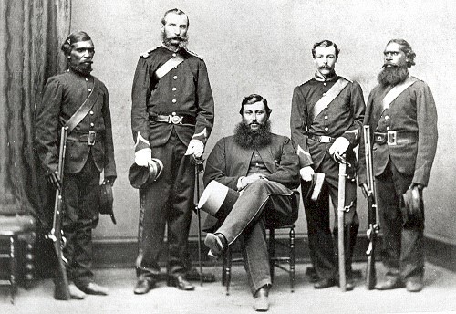 Study Aboriginal scars from frontier wars Study: Aboriginal scars from frontier wars