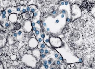 Report: New app collects the sounds of COVID-19 Report: New app collects the sounds of COVID-19