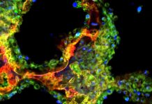 Researchers invent nanoparticle that could improve treatment for bone defects Researchers invent nanoparticle that could improve treatment for bone defects