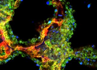 Researchers invent nanoparticle that could improve treatment for bone defects Researchers invent nanoparticle that could improve treatment for bone defects