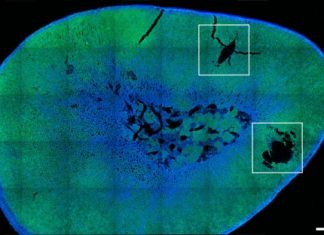 Scientists achieve remote control of hormone release Scientists achieve remote control of hormone release