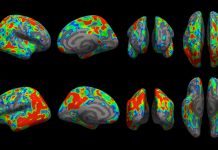 New imaging tool helps scientists see extent of Alzheimer’s early damage New imaging tool helps scientists see extent of Alzheimer’s early damage
