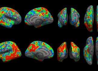 New imaging tool helps scientists see extent of Alzheimer’s early damage New imaging tool helps scientists see extent of Alzheimer’s early damage