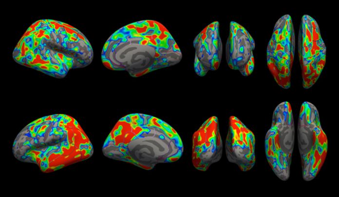 New imaging tool helps scientists see extent of Alzheimer’s early damage