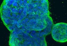 Research unveils many ways carcinogens trigger development of breast cancer Research unveils many ways carcinogens trigger development of breast cancer