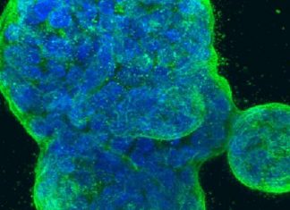 Research unveils many ways carcinogens trigger development of breast cancer