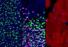 Researchers create first roadmap of human skeletal muscle development Researchers create first roadmap of human skeletal muscle development