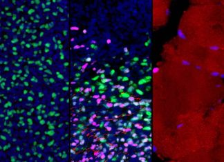 Researchers create first roadmap of human skeletal muscle development Researchers create first roadmap of human skeletal muscle development