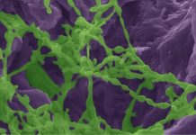 Study: Microorganisms in parched regions extract needed water from colonized rocks Study: Microorganisms in parched regions extract needed water from colonized rocks