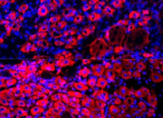 Study: Diluting blood plasma rejuvenates tissue, reverses aging in mice Study: Diluting blood plasma rejuvenates tissue, reverses aging in mice