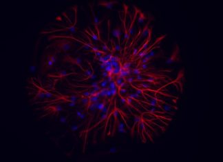 Study: Gold nanoparticles to save neurons from cell death Study: Gold nanoparticles to save neurons from cell death