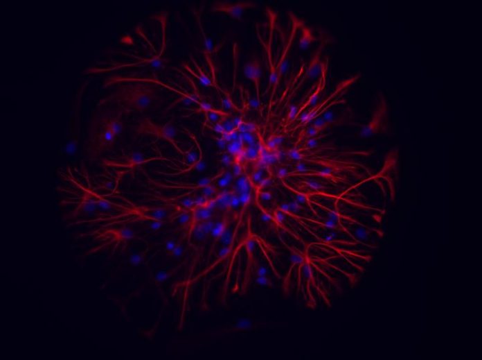 Study: Gold nanoparticles to save neurons from cell death