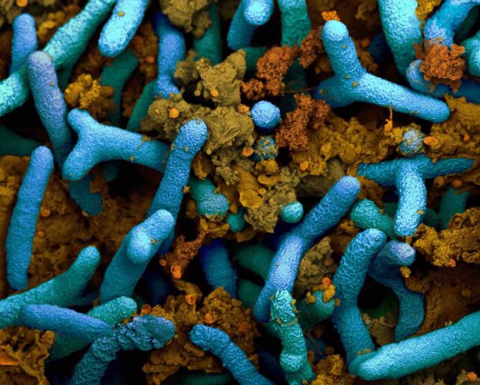Study: How bacteria fertilize soya