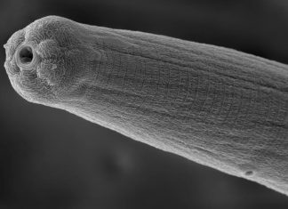 Study: Parasitic worm venom evades human immune system Study: Parasitic worm venom evades human immune system