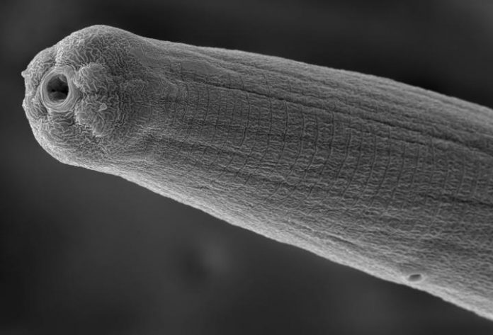 Study: Parasitic worm venom evades human immune system