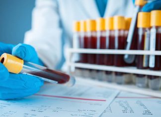 Study: Widely used blood test could advance heart failure treatment Study: Widely used blood test could advance heart failure treatment