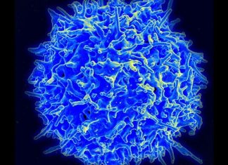 Study: Inflammatory bowel disease linked to an immune cell run amok