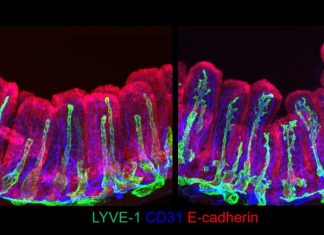 Study: Newly identified gut cells nurture lymph capillaries Study: Newly identified gut cells nurture lymph capillaries