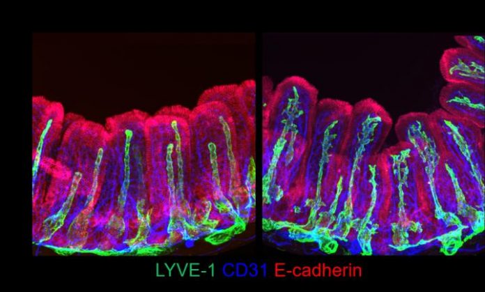 Study: Newly identified gut cells nurture lymph capillaries
