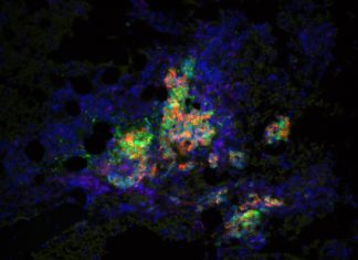Study: Reprogramming immune cells to reduce inflammation Study: Reprogramming immune cells to reduce inflammation