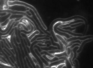 Scientists discover a novel family of toxins used in bacterial competition Scientists discover a novel family of toxins used in bacterial competition