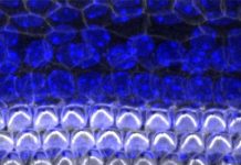 Scientists identify role of protein in development of new hearing hair cells Scientists identify role of protein in development of new hearing hair cells