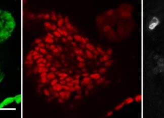Study: A scientific advance in studying early-stage lung cancer Study: A scientific advance in studying early-stage lung cancer