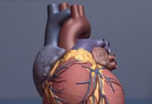 Study: Biologic therapy for psoriasis may reduce heart disease Study: Biologic therapy for psoriasis may reduce heart disease