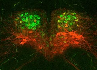 Study: Misfiring brain cells may cause swallowing woes in children with developmental disorders Study: Misfiring brain cells may cause swallowing woes in children with developmental disorders