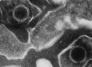 Study: Novel therapeutic approach against Epstein-Barr virus-associated tumors Study: Novel therapeutic approach against Epstein-Barr virus-associated tumors