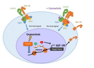 Study: Potential drug treatment for particular type of lung-cancer Study: Potential drug treatment for particular type of lung-cancer