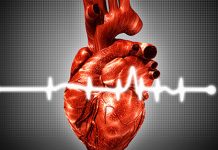 Research finds treat-to-target ULT strategy manages gout effectively and safely with no cardiovascular toxicity Research finds treat-to-target ULT strategy manages gout effectively and safely with no cardiovascular toxicity
