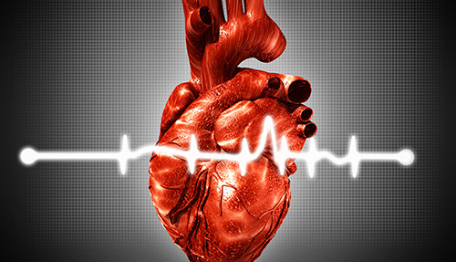 Research finds treat-to-target ULT strategy manages gout effectively and safely with no cardiovascular toxicity Research finds treat-to-target ULT strategy manages gout effectively and safely with no cardiovascular toxicity